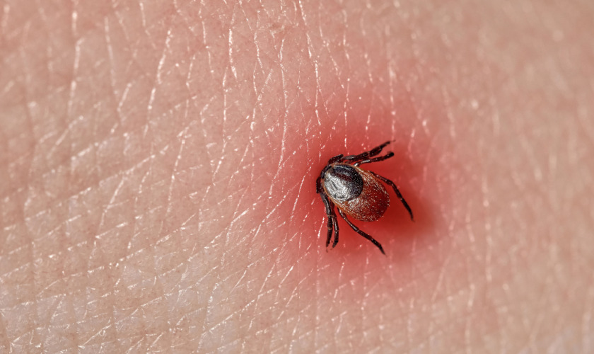 Tick Control in Maine